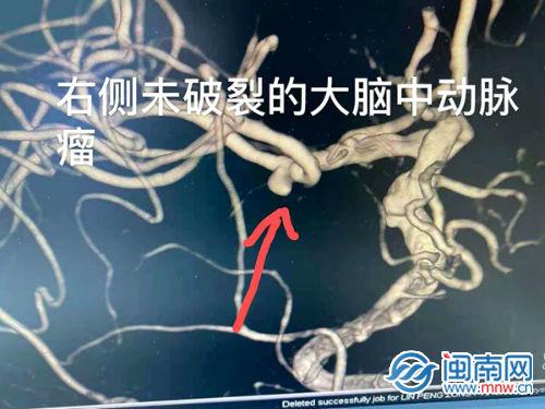 假的比特币分叉币，警惕假的比特币分叉币：全面解析风险与应对策略